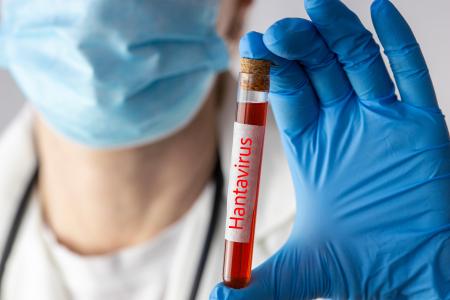 2 articles médicaux publiés dans le Canadian Medical Association Journal (CMAJ) offrent une synthèse des données cliniques essentielles sur l'hantavirus et la maladie à virus Ebola (Visuel Adobe Stock 2013944563)