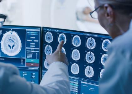 Des changements de forme du cerveau constituent des signes avant-coureurs de démence (Visuel Adobe Stock 236237463)