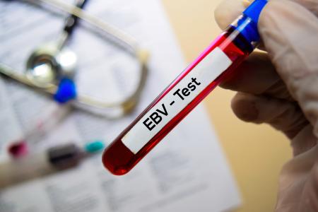 L'inhibition d'une voie métabolique spécifique dans les cellules infectées pourrait permettre de diminuer l'infection latente d'EBV (Visuel Adobe Stock 287154516)