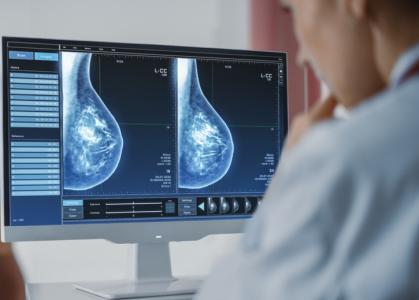 Le dépistage mammographique assisté par l’IA permet de réduire le nombre des cancers du sein agressifs et avancés (Visuel Adobe Stock 422714239)