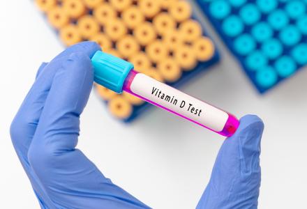 La recherche montre chez l’animal que la vitamine D favorise la croissance d'un type de bactérie intestinale qui améliore l'immunité contre cancer (Visuel Adobe Stock 479948972)