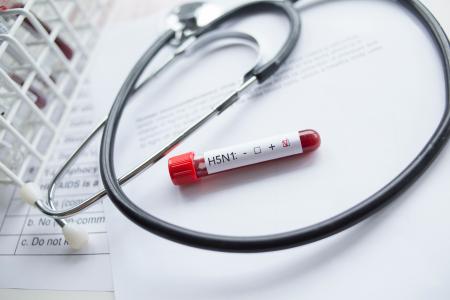 Cette analyse épidémiologique et virologique complète plaide en faveur d'une initiative multi gouvernementale pour faire face au retour de la grippe aviaire H5N1 (Visuel Adobe Stock 535617899) Cette analyse épidémiologique et virologique complète plaide en faveur d'une initiative multi gouvernementale pour faire face au retour de la grippe aviaire H5N1 (Visuel Adobe Stock 535617899)