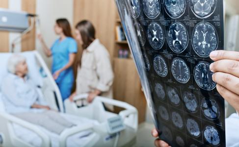 Cette recherche identifie les principaux réseaux cérébraux responsables de l'incontinence urinaire post-AVC (Visuel Adobe Stock 544305440)