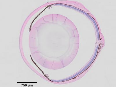 Et si les affections oculaires dégénératives qui conduisent au glaucome, à la dystrophie cornéenne et à la cataracte pouvaient être détectées et traitées avant que la vision ne soit altérée ? (Visuel Corps ciliaire- Ting Xie Lab) Et si les affections oculaires dégénératives qui conduisent au glaucome, à la dystrophie cornéenne et à la cataracte pouvaient être détectées et traitées avant que la vision ne soit altérée ? (Visuel Corps ciliaire- Ting Xie Lab)