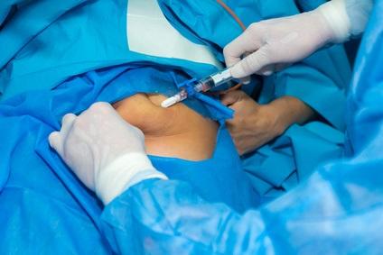 Le remodelage corporel favorise-t-il la perte de poids à long terme après une chirurgie bariatrique ? (Visuel Fotolia 178236449)