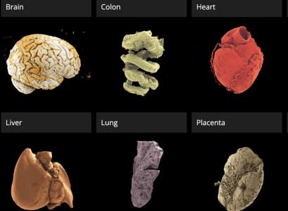 Ce nouveau portail 3D en libre accès permet aux utilisateurs d'explorer des organes humains intacts avec une précision sans précédent (Visuel GOOGLE EARTH screenshot of the Human Organ Atlas portal)