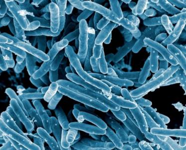 Mycobacterium tuberculosis, la bactérie responsable de la tuberculose (Visuel NIAID) Mycobacterium tuberculosis, la bactérie responsable de la tuberculose (Visuel NIAID)