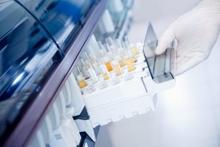 Des bactéries comme E. coli et Lactobacillus retrouvées normalement à faibles niveaux dans les urines, qui proviennent de communautés bactériennes qui siègent dans les reins, peuvent favoriser ou empêcher la formation de calculs rénaux (Visuel Adobe Stock 334065984)