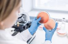 58 % des patients touchés par l'épidémie de mpox de 2022 signalent toujours des symptômes physiques persistants (Visuel Adobe Stock 1261232600)