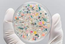 Les microplastiques minent aussi la santé osseuse (Visuel Adobe Stock 1454991029) Les microplastiques minent aussi la santé osseuse (Visuel Adobe Stock 1454991029)