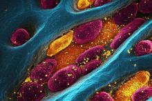Une molécule d'origine végétale qui décompose l'amyloïde pathogène, impliquée dans l’amylose à transthyrétine (Visuel Adobe Stock 1827053845) Une molécule d'origine végétale qui décompose l'amyloïde pathogène, impliquée dans l’amylose à transthyrétine (Visuel Adobe Stock 1827053845)