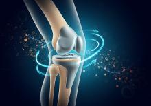 3 études mettent en vant les avantages de l’ostéointégration pour les personnes amputées (Visuel Adobe Stock 1899570321) 3 études mettent en vant les avantages de l’ostéointégration pour les personnes amputées (Visuel Adobe Stock 1899570321)