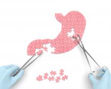 La chirurgie bariatrique peut être une stratégie efficace contre l’obésité et ses comorbidités chez les patients éligibles plus jeunes aussi (Visuel Adobe Stock 225089725)
