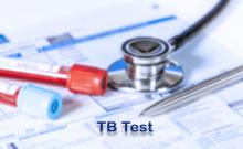 Cette nouvelle approche combinée consiste à détecter simultanément la tuberculose active et la tuberculose latente (Visuel Adobe Stock 541355475)
