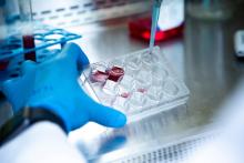 La plupart des cas d'Alzheimer sont liés aux variants d'un seul gène (Visuel Adobe Stock 563005561) La plupart des cas d'Alzheimer sont liés aux variants d'un seul gène (Visuel Adobe Stock 563005561)