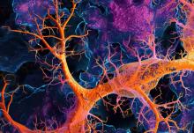 Cette protéine, la tubuline prévient la formation d'agrégats protéiques toxiques dans le cerveau (Visuel Adobe Stock 832550283)
