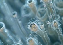 Déjà développé pour détecter les bactéries aéroportées et les infections nosocomiales, ce dispositif de nez électronique trouve une nouvelle application, la détection des moisissures ou champignons dans les espaces intérieurs (Visuel Adobe stock 916243292) Déjà développé pour détecter les bactéries aéroportées et les infections nosocomiales, ce dispositif de nez électronique trouve une nouvelle application, la détection des moisissures ou champignons dans les espaces intérieurs (Visuel Adobe stock 916243292)