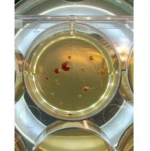 L'antibiorésistance, le fait de quelques microbes solitaires ? L'antibiorésistance, le fait de quelques microbes solitaires ?