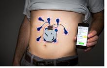 Ce mode de La surveillance de l'activité gastro-intestinale chez les patients en dehors du contexte clinique va permettre d’accroître la probabilité de capter les événements anormaux, tout en évitant certains examens invasifs, et de réduire les coûts. Ce mode de La surveillance de l'activité gastro-intestinale chez les patients en dehors du contexte clinique va permettre d’accroître la probabilité de capter les événements anormaux, tout en évitant certains examens invasifs, et de réduire les coûts.