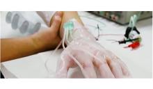 Ce dispositif innovant a non seulement la capacité de fournir, à la main blessée, une thérapie par pression négative, mais aussi des agents thérapeutiques et de contrôler l'environnement de la plaie. Ce dispositif innovant a non seulement la capacité de fournir, à la main blessée, une thérapie par pression négative, mais aussi des agents thérapeutiques et de contrôler l'environnement de la plaie.