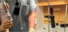 Cette technique d’imagerie par résonance magnétique non invasive permet de suite l'évolution de la fibrogénèse Cette technique d’imagerie par résonance magnétique non invasive permet de suite l'évolution de la fibrogénèse