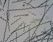 Ces nanorobots ont été développés en recouvrant des algues minuscules de particules magnétiques biocompatibles. Ces nanorobots ont été développés en recouvrant des algues minuscules de particules magnétiques biocompatibles.