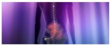 La stimulation épidurale est efficace à rétablir le mouvement et la fonction autonome chez des patients atteints de paralysie complète et restés sans traitement durant des années. La stimulation épidurale est efficace à rétablir le mouvement et la fonction autonome chez des patients atteints de paralysie complète et restés sans traitement durant des années.