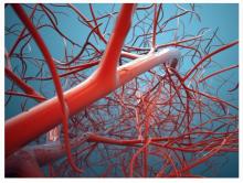 Réduire les niveaux d’une protéine spécifique des cellules des vaisseaux sanguins permettrait de contrer le développement de ces maladies cardiovasculaires (Visuel Fotolia).